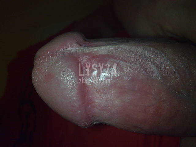 Zdjęcie033.jpg - LYSY24