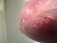 dick