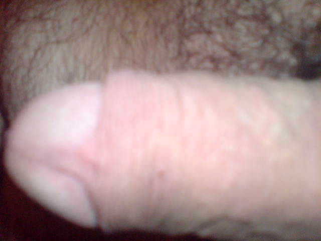 np84