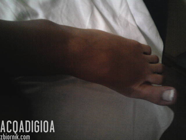 stopka - acqadigioa