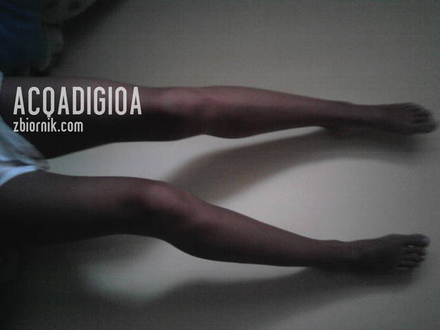 acqadigioa