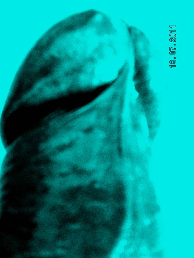 bighoy