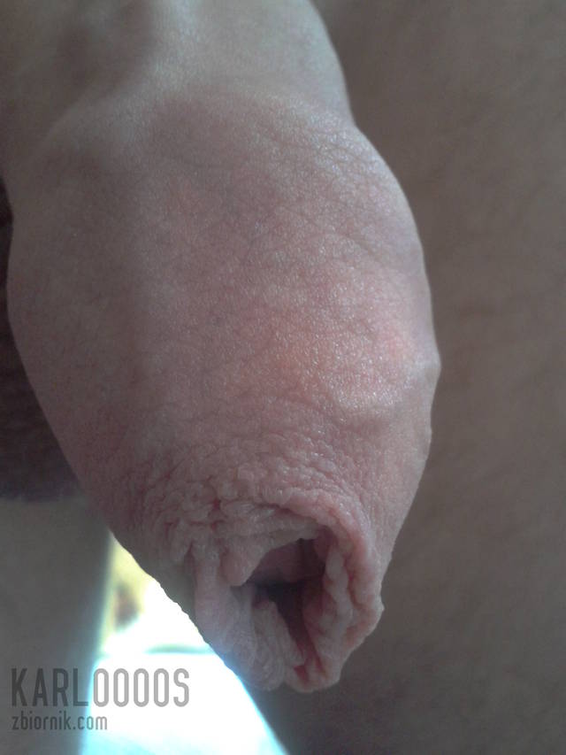 Karloooos