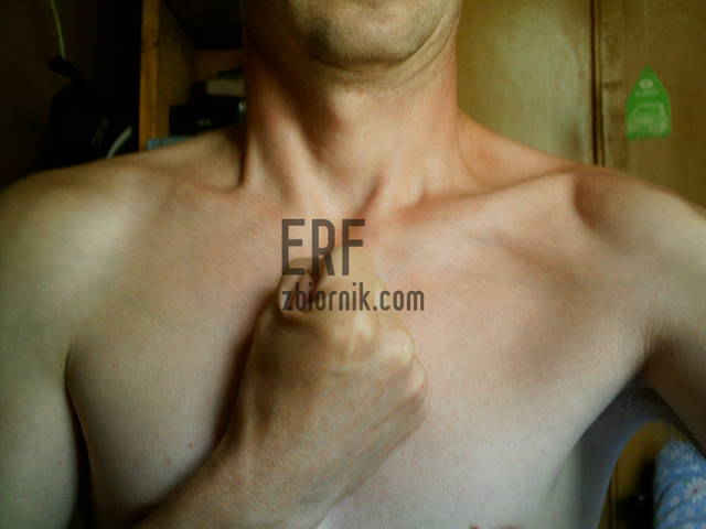 Erf