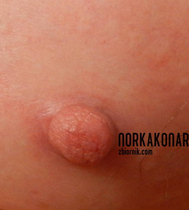 norkakonar