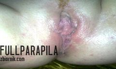 cipka