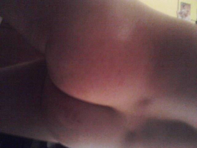 norx