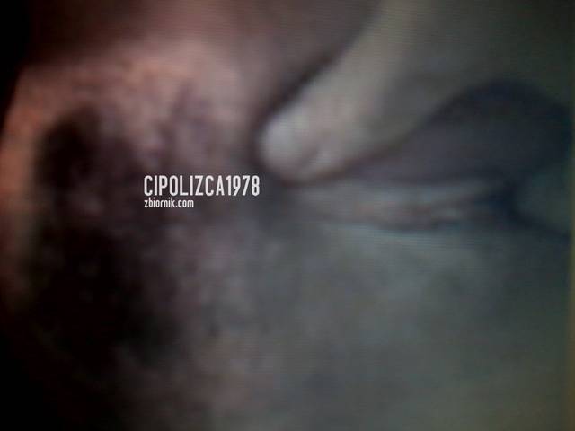 cipolizca1978