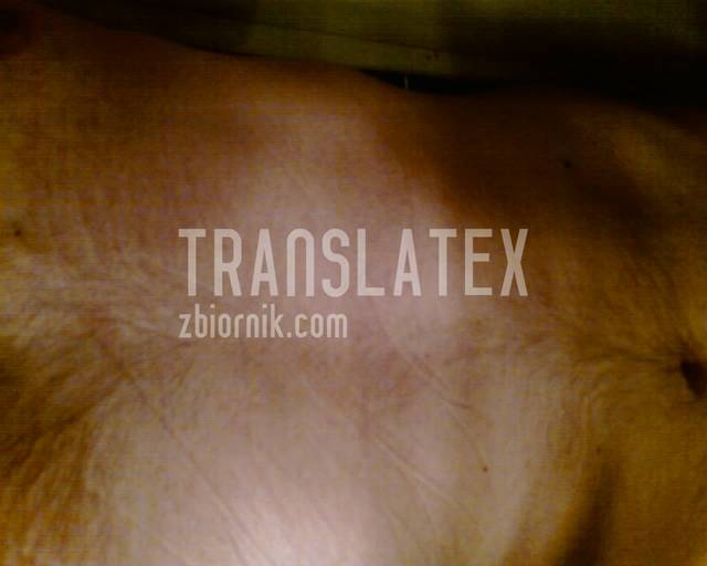 translatex