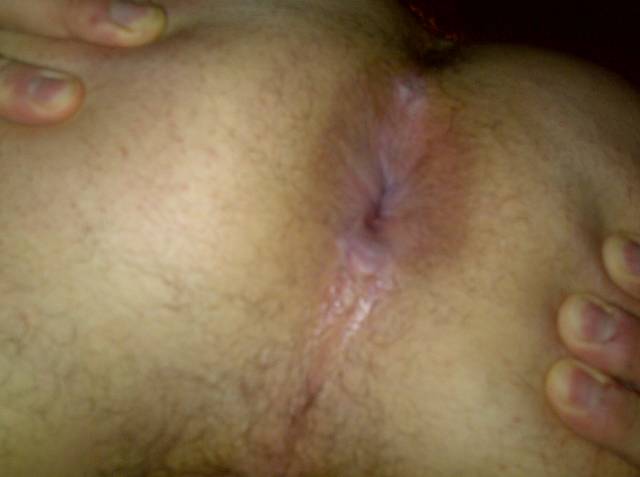 sos31