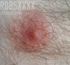 coś innego?