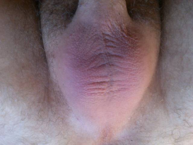 Jajeczka - Dick_er