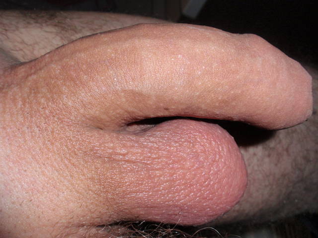 RAFAL1978