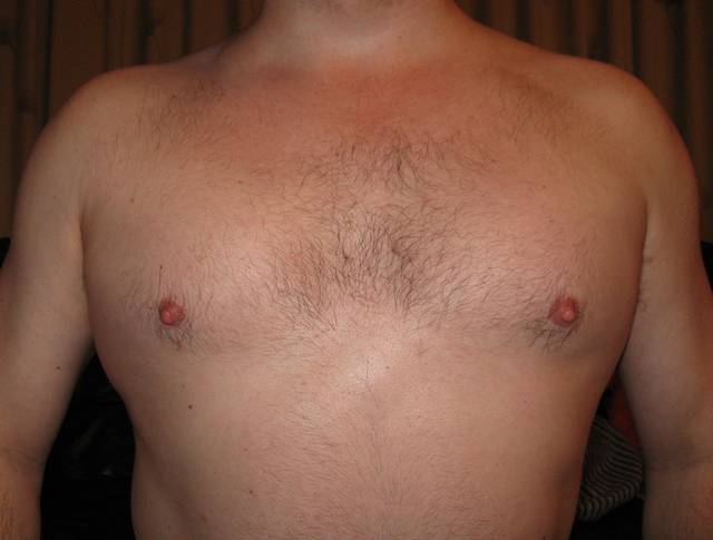 Me - musbrus