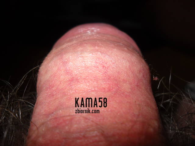 lizaczek - kama58