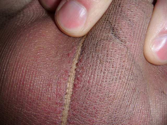 doctorrectus