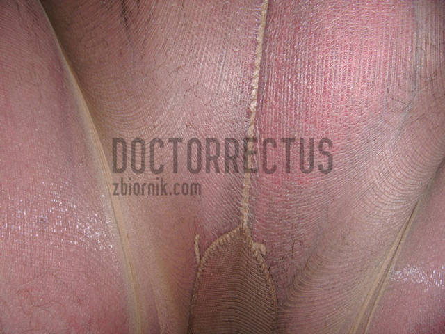 doctorrectus