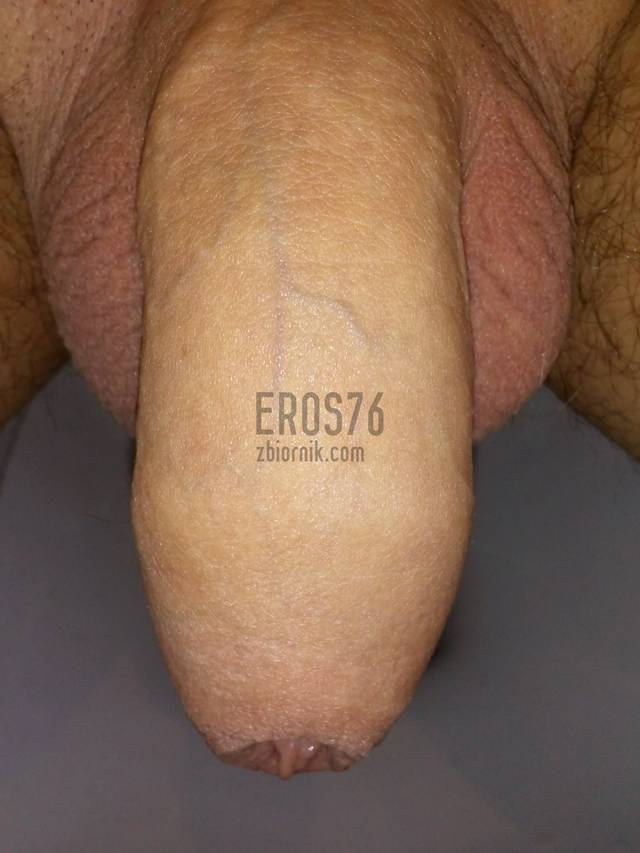 eros76