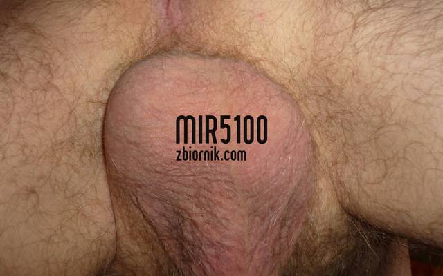 mir5100