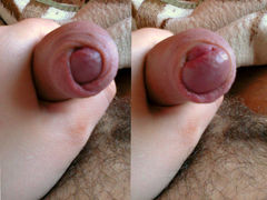 collage