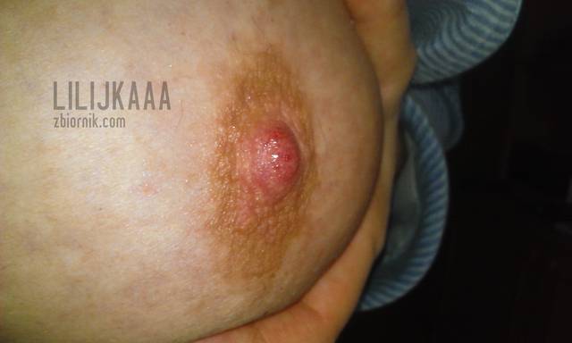 Lilijkaaa