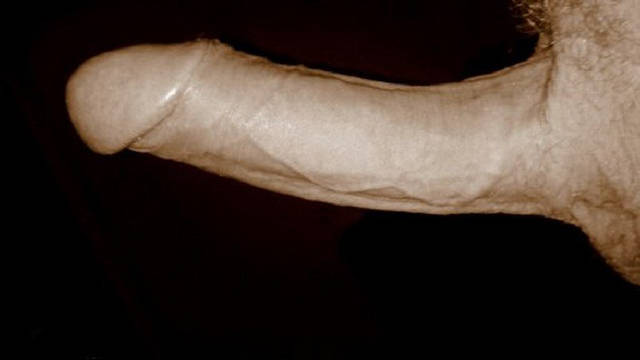 artolo