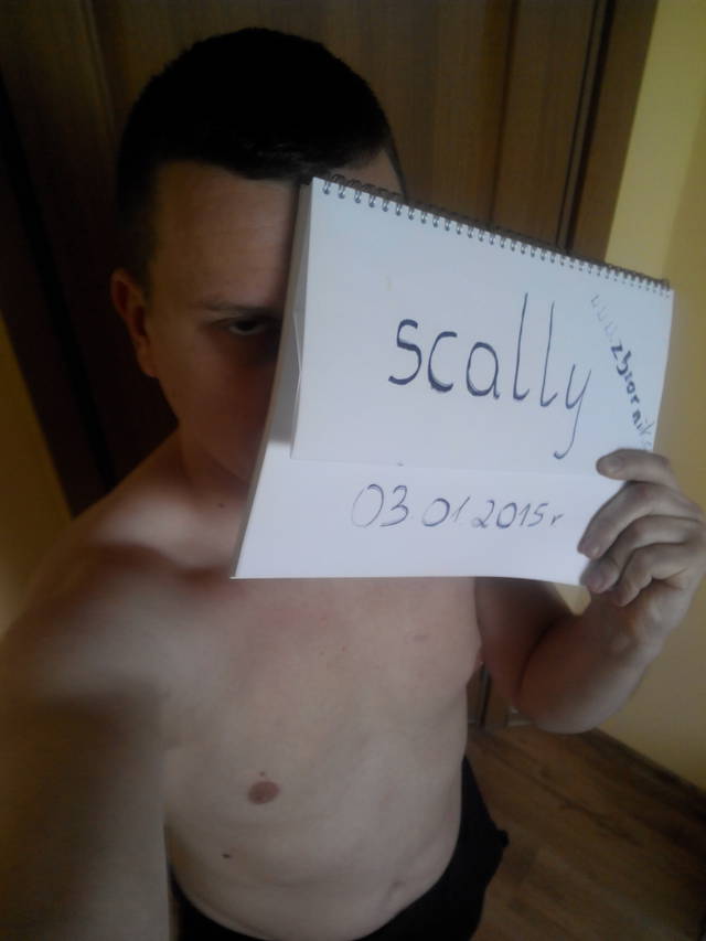 scally
