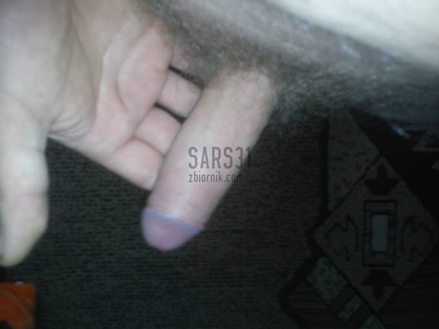 sars31