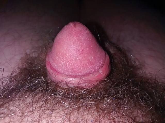 mrradas