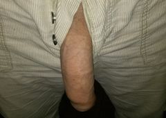 upsss
