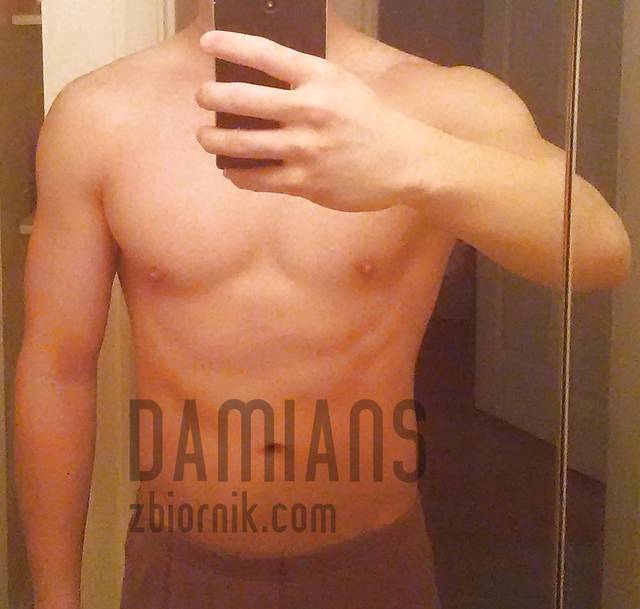 damians