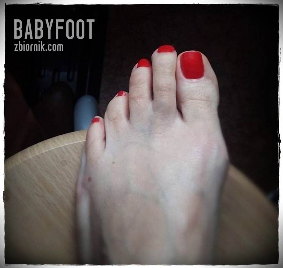 czerwone lizaczki - Babyfoot