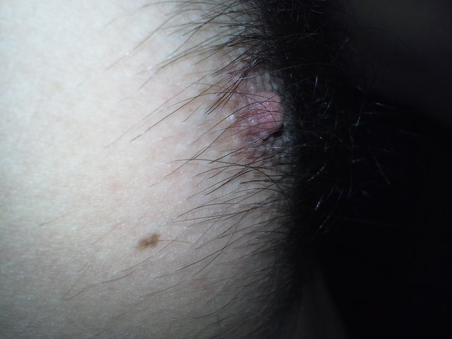 eu_genis