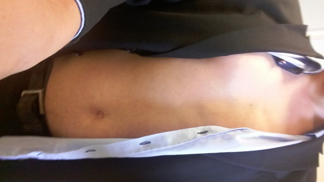 amoniak32