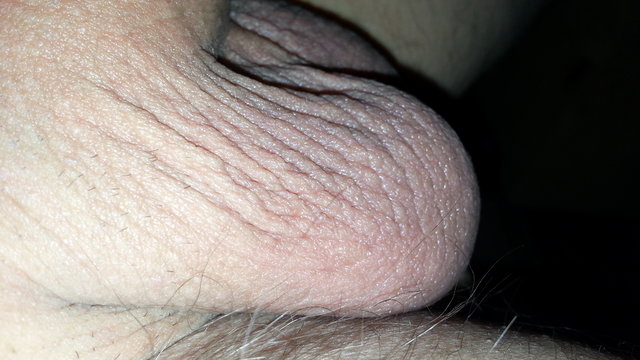 daras1