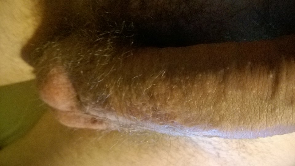 WP_20170125_21_45_50_Pro.jpg - collar84