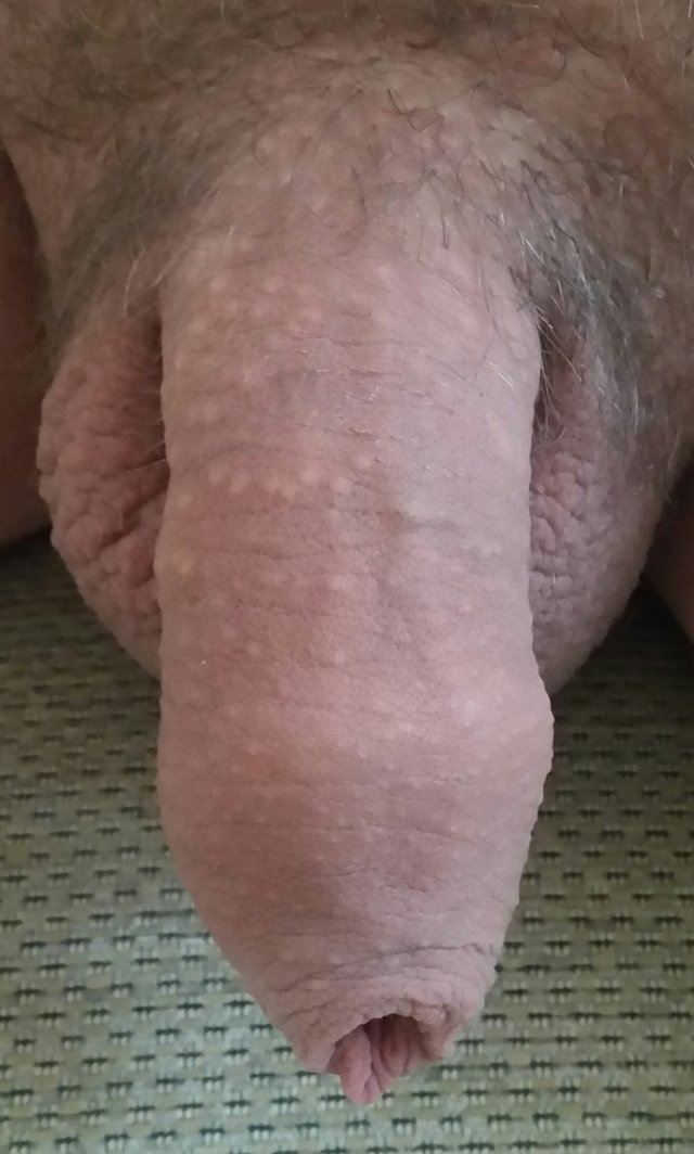 plusz098