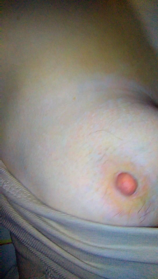 VIDEO0161_0000031614.jpg - onilubiacyto