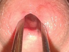 20171112_080305.jpg