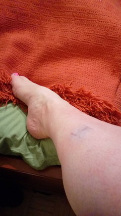Siniaczek