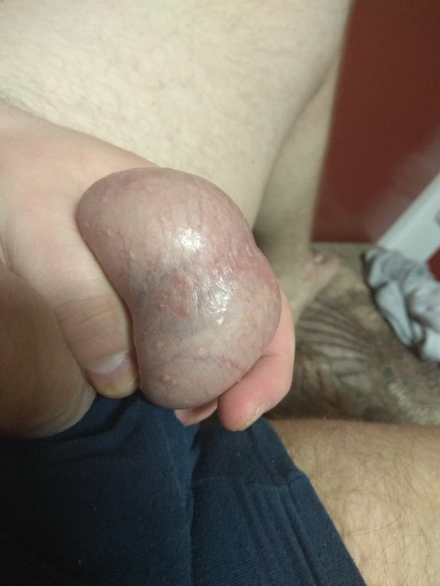 Narko92