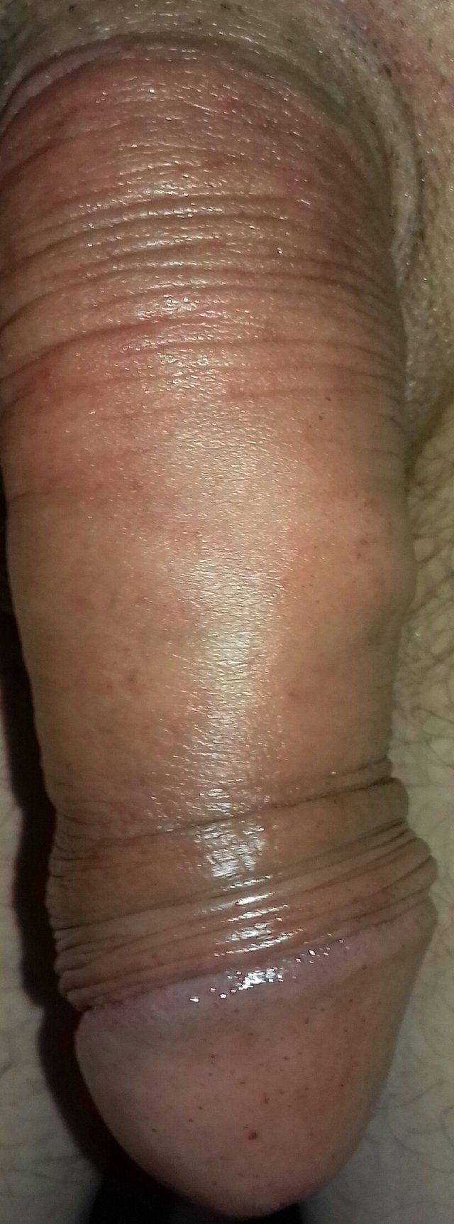 bolus36