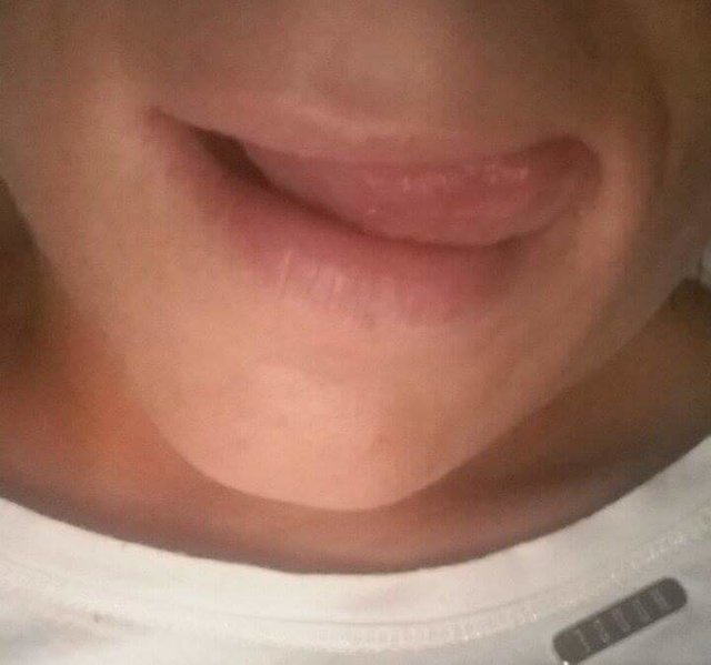 Rexnoctu