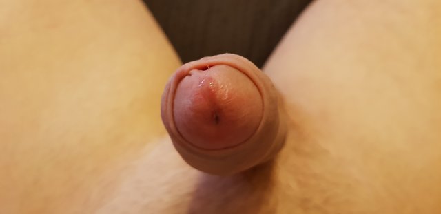 onChce31