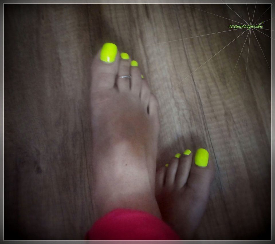 Neon Yellow #84 - 100pa100peczka