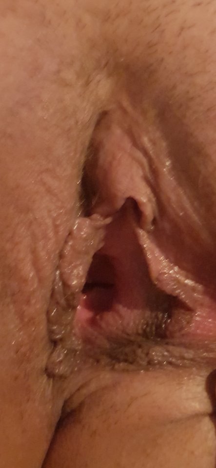 20181222_231607.jpg - Endofinki