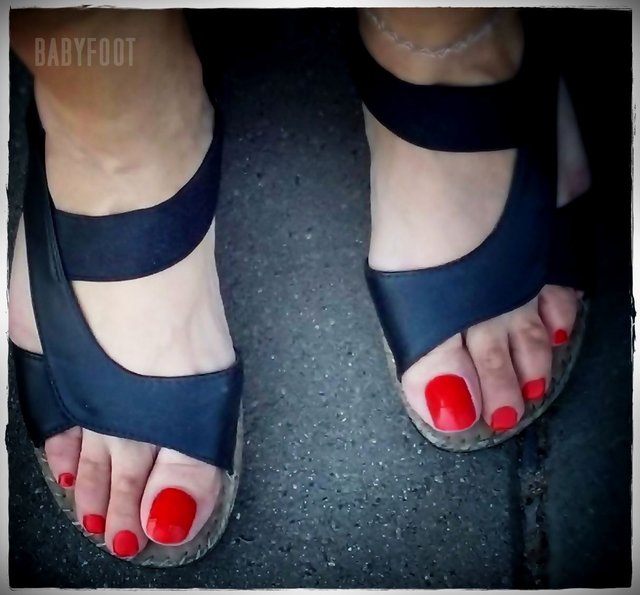 Babyfoot