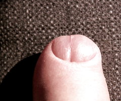 395_1000.jpg