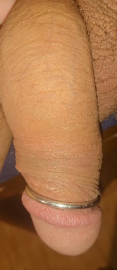 Ring1