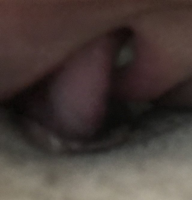 nanowomy